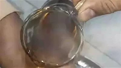 الحروق مش تحدي.. برنامج جروب الماميز يناشد الأعلى للإعلام ووزيري التعليم والشباب بالتحرك ضد تريند الشاي