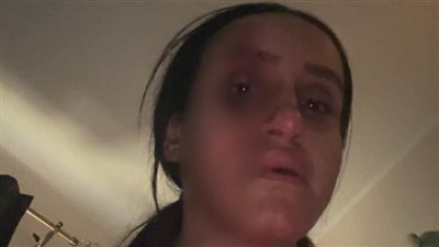 عرض المتهم بالتعدي على زوجته وإصابتها في بشتيل على جهات التحقيق