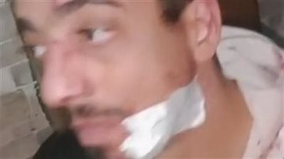 الاستماع إلى أقوال بائع أحذية ضحية اعتداء صاحب محل وآخرين في جسر السويس