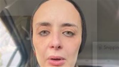 دمرلي أسناني وحصلي مضاعفات.. صانعة محتوى تزعم تعرضها لإهمال طبي من عيادة أسنان شهيرة 