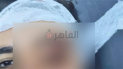 قطع في عضلات العين.. مدير مستشفى الجامعة يكشف الحالة الصحية للعامل المعتدى عليه بفاقوس
