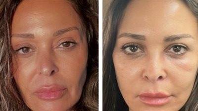 بعد إجرائها عملية تجميل.. داليا البحيري: شكرا لكل اللي سأل عليا وكان من الصعب أن أظهر دون مكياج