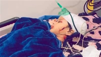 يحتاج لجراحة طارئة.. كلب ضال يعقر صغيرا بمدينة رأس سدر في جنوب سيناء