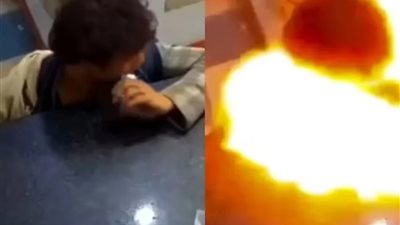 مراهق يقضم بطارية