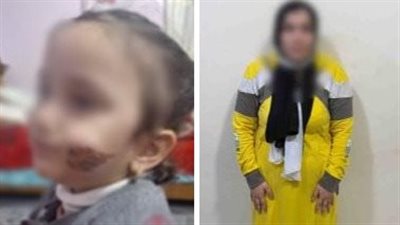 جهات التحقيق تقرر نقل حضانة الطفلة المعذبة من قبل والدتها للجدة للأب بكفر الشيخ.. وحجز الأم لتحريات المباحث 