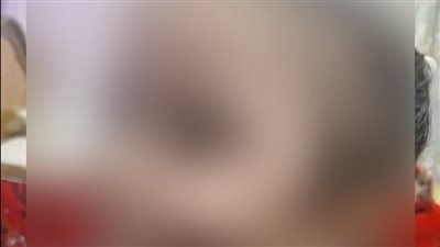 طليق والدتها.. الأم المتهمة بتشويه طفلتها في كفر الشيخ: كوتها بالشوكة لأنها راحت عند أبوها