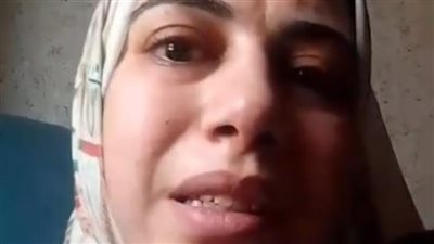 مرض نادر.. استغاثة أم بالمنوفية لإنقاذ صغيرتها: جلدها غير مكتمل وبتتوجع كأنها محروقة طول الوقت