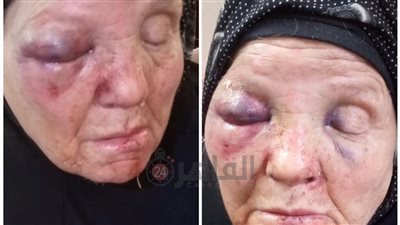 ضبط شاب لاتهامه بالتعدي على والدته المسنة بزفتى بالغربية 
