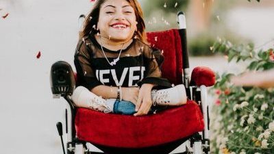 وجه مارينا.. ضحكات تواجه “آلام” مرضها النادر (صور)