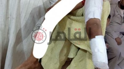 “الضنا مابقاش غالي”.. أب يعذب طفلته بالحرق بسبب خلافات مع طليقته في قنا