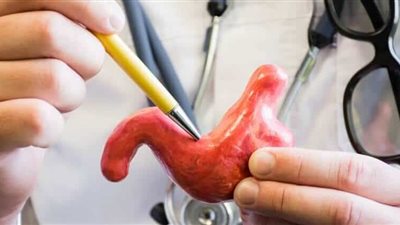 خبيرة تغذية توضح الأطعمة المطلوبة بعد عمليات تكميم المعدة وتحويل المسار