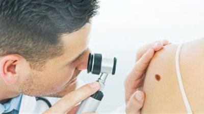 طبيب جلدية وتناسلية يجيب عن أهم أسئلة قراء “القاهرة 24”