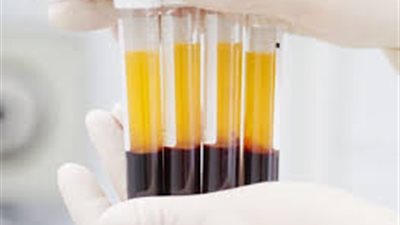 جدل بـ”صحة النواب” بشأن سرية بيانات المتبرعين بالدم