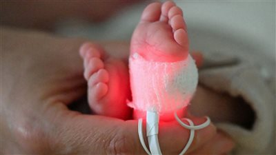قد تشوه الأجنة.. دراسة علمية تحذر من المواد الكيميائية الأبدية 