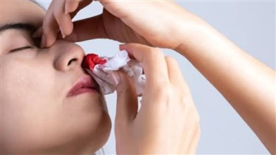 حالة مرضية شائعة تسبب نزيف الأنف.. تعرف عليها