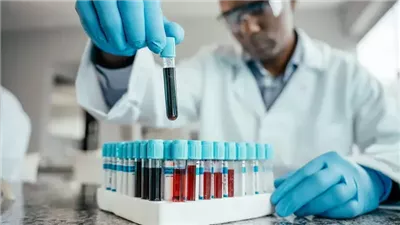 دراسة تكشف عن الصلة بين خطر الإصابة بالسرطان وحالة شائعة متعلقة بالدم