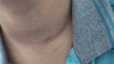 فصلوا الولد وتعرض للتنمر واعتداء لفظي.. ولية أمر تستغيث من إجراءات مشددة من مدرسة شهيرة مع نجلها | خاص