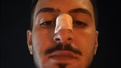 شاب يستغيث من الاعتداء عليه 