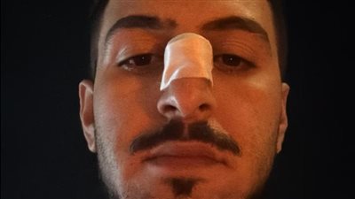الشاب المعتدى عليه    