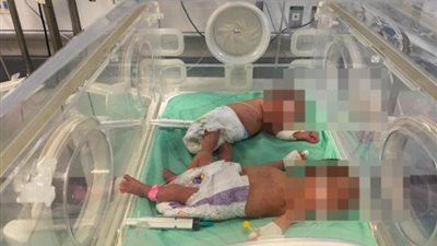  أم تستغيث من تعرض صغيريها لـ إهمال طبي 