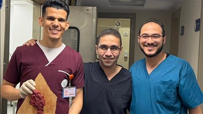 لأول مرة.. نجاح استئصال ورم ضخم يزيد حجمه عن 10 سم دون جراحة بمجمع الشفاء الطبي ببورسعيد