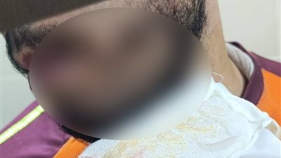 تسبب له في 36 غرزة بالوجه.. سايس يعتدي على مندوب طلبات بسلاح أبيض في حدائق القبة