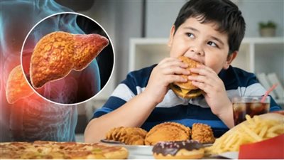 علامات وعوامل إصابة الصغار بمرض الكبد الدهني 