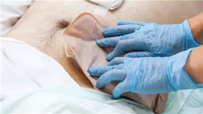 ببصمة ميكروبية.. اكتشاف علمي جديد قد يسهم في تحسين الكشف المبكر عن سرطان القولون