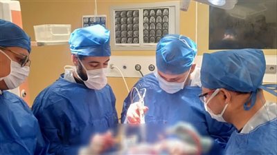 نجاح أول عملية استئصال ورم المخ بجهاز كوزا في الأقصر
