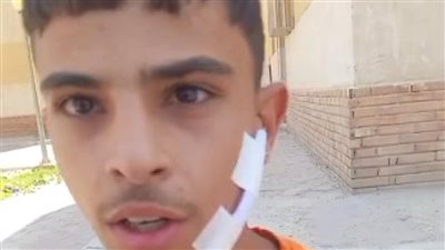 شاب يستغيث بعد الاعتداء عليه بسلاح أبيض في أكتوبر: خضعت لعملية جراحية 60 غرزة