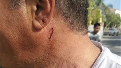 استجواب أيمن يونس في واقعة الاعتداء عليه.. ومصدر: إصابته طفيفة