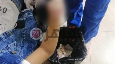 استجابة لما نشره “القاهرة 24”.. محافظ الفيوم: توفير طرف صناعي مستورد للطفل زياد فور تعافي الجرح