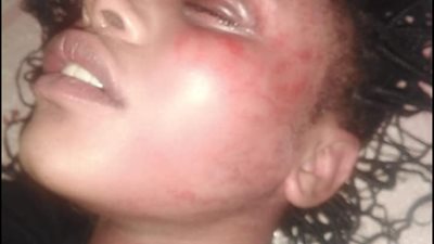 فتاة سودانية تكشف محاولة خطفها أعلى الدائري: “لجأت لمفوضية شؤون اللاجئين ومحدش رد عليَّا” (صور)