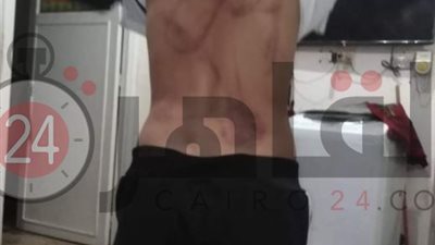 أب يعتدي على نجله بالضرب بكابل كهربائي بسبب 