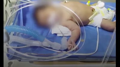 بتر ذراع و130 ألف جنيه.. اتهام 4 أطباء ومستشفى خاص بالإهمال في رعاية رضيع