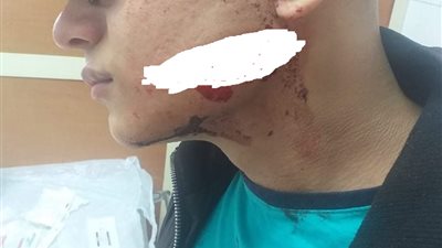 لرفضه دفع إتاوة.. مسجل خطر يمزق وجه طالب بالمحلة 