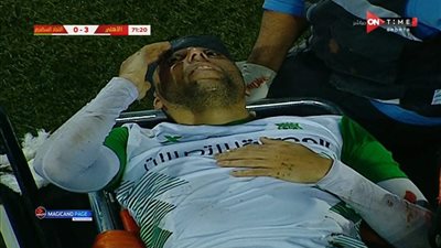 الاتحاد السكندري يكشف تطورات الحالة الصحية لمحمد عطوة