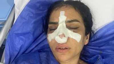 رُحت أتمرن خرجت بكسر في أنفي.. أول تعليق من ياسمين حمدي صحابة واقعة البيلاتس بالساحل