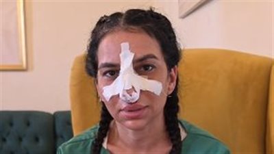  كسر بالأنف وتكلفة علاج 140 ألف جنيه.. ننشر التقرير الطبي لياسمين حمدي بعد واقعة البيلاتس
