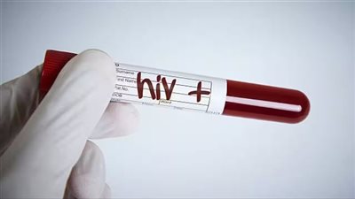 تؤخذ مرة واحدة أسبوعيًا.. دراسة تحدد حبوبًا جديدة لعلاج فيروس نقص المناعة البشرية
