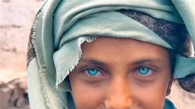 بسبب عيونه الزرقاء.. صغير يمني يتحول من بائع متجول إلى إنفلونسر شهير