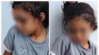 بعد تداول صورها.. القومي للطفولة ينقذ صغيرة الهانوفيل ويودعها دار رعاية