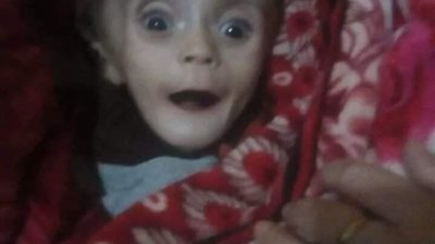 خاص.. القصة الكاملة لطفل رفضت 3 مستشفيات حكومية وخاصة علاجه (صور وفيديو)