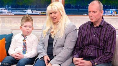 ولادة طفل بلا دماغ تحير العلماء!.. تعرف على حكايته