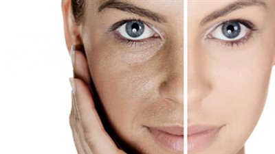 تعرف على طرق العلاج الطبيعي للبقع الداكنة على الوجه