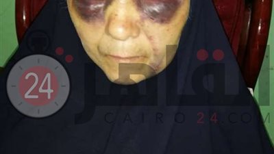 ضربها واشتكى.. إخلاء سبيل سيدة تعدى عليها نجلها في كفر الشيخ