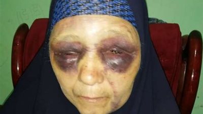 تحريات المباحث في واقعة الابن العاق بكفر الشيخ: 