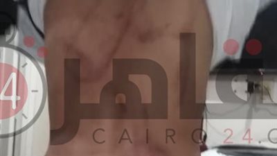 جنح قليوب تؤجل محاكمة أب عذّب نجله بكابل كهربائى لجلسة 20 يناير