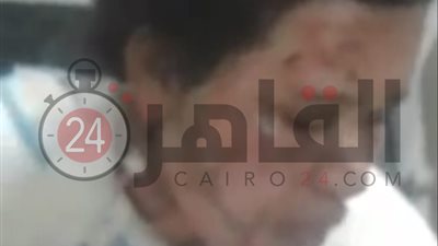 النيابة تأمر بتشريح جثة ربة منزل توفيت 