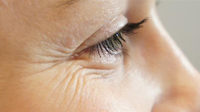 لعلاج الشيخوخة.. 5 نصائح لعلاج تجاعيد الوجه في الشتاء